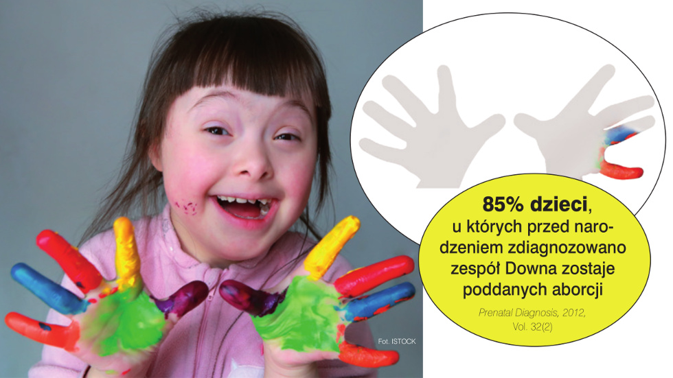 obrona dzieci